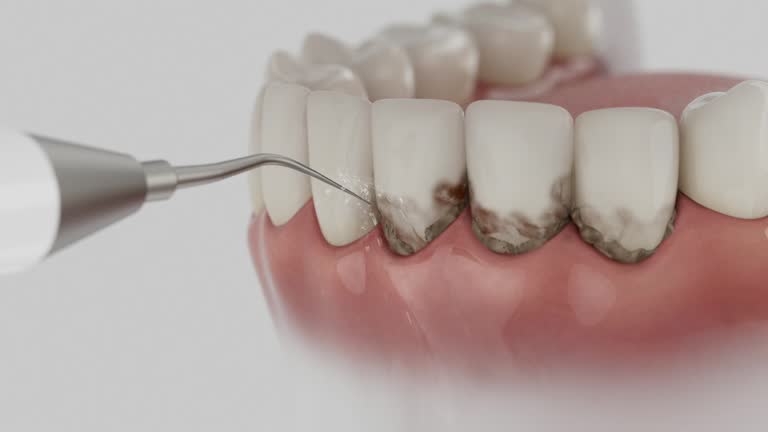 Reliable Dental Implants contractor in Martin, TN by Smile Center Dentistry